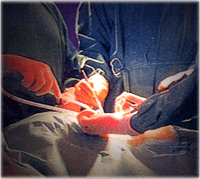 Diagnostics, Bone Surgery, Ophthalmology, Tracheotomy, Vaccination and Puncture, General Instruments, ENT Surgery, Cardiovascular, Bone Surgery Instruments, Surgery Products, Gynecology Products, Cardio Surgical Instruments, Beauty Care Products, Dental Products, Dental Surgical Products, General Instruments, Suture, Plaster, Diagnostics, Neurosurgery Instruments, Sialkot, Pakistan. Diagnostics, Bone Surgery, Ophthalmology, Tracheotomy, Vaccination and Puncture, General Instruments, ENT Surgery, Cardiovascular, Bone Surgery Instruments, Surgery Products, Gynecology Products, Cardio Surgical Instruments, Beauty Care Products, Dental Products, Dental Surgical Products, General Instruments, Suture, Plaster, Diagnostics, Neurosurgery Instruments, Sialkot, Pakistan.